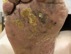 Валентина Ивановна, 72 года